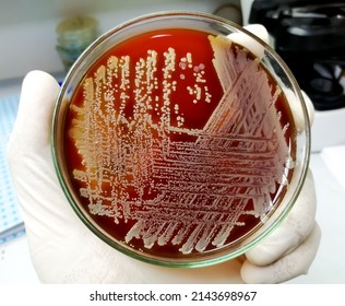 Staph aureus: Gram positive bacteria. Staphylococcus or streptococcus growth on blood agar. closeup.