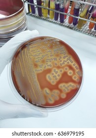 Staphylococcus Aureus