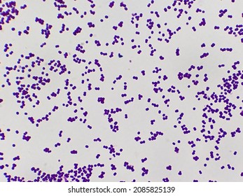 Staphylococcus aureus bacteria microscopic image - Shutterstock ID 2085825139