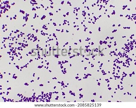 Staphylococcus aureus bacteria microscopic image
