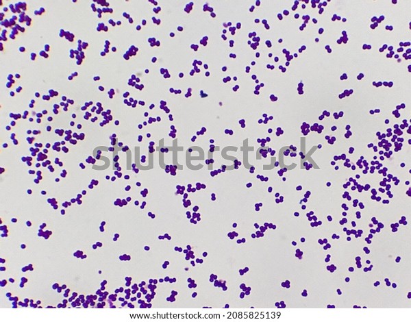 Staphylococcus Epidermidis Gram Stain 