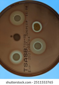 Staphylococcus aureus bacteria spots on blood agar