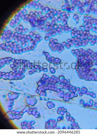 Staphylococcus aureus bacteria under the microscope