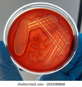 Beta Hemolytic Staphylococcus On Blood Agar Stock Photo 1741813406 ...