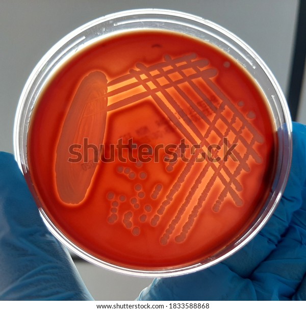 Staphylococcus Aureus Beta Hemolytic Colonies Stock Photo 1833588868 ...