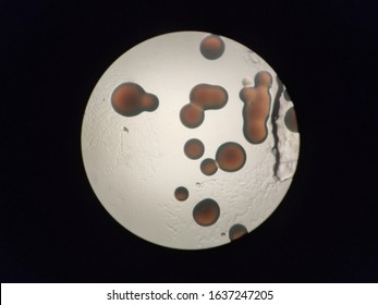 Staphylococcus aureus colonies on nutrient agar under the microscope