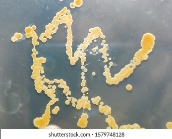 702 Staphylococcus aureus petri dish Stock Photos, Images & Photography ...