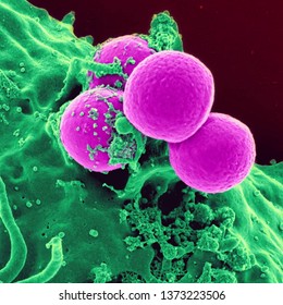 구균 황색 포도상 황색포도상구균(Staphylococcus aureus)