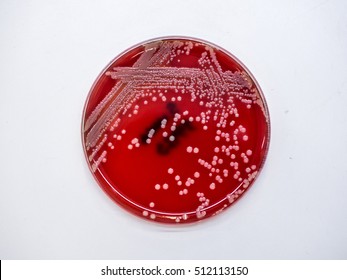 1,147 Staphylococcus aureus background Images, Stock Photos & Vectors ...