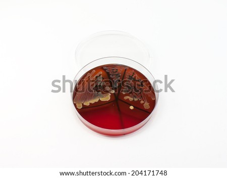 Staphylococcus aureus and Enterococcus faecalis bacterium on petri dish