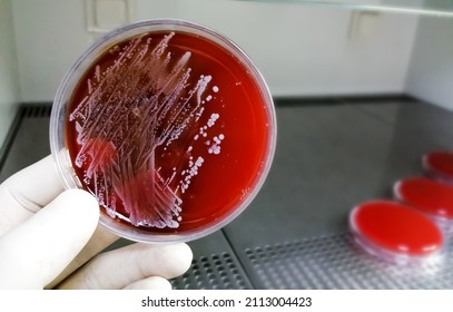 Staphylococcus aureus: Gram-positive, to Gram-variable, nonmotile, Coccus, beta hemolysis, saprotrophic bacterium that belongs to the family Staphylococcus growth on blood agar.