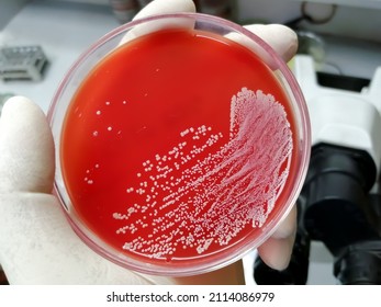 Staphylococcus Aureus Grampositive Gramvariable Nonmotile Coccus Foto ...