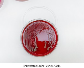 Staphylococcus aureus: Gram-positive, to Gram-variable, nonmotile, Coccus,beta haemolysis, saprotrophic bacterium that belongs to the family Staphylococcus growth on blood agar.