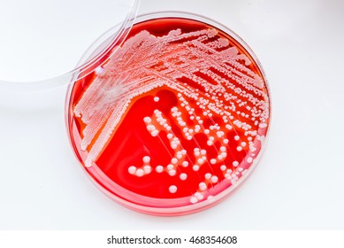 Staphylococcus aureus: Gram-positive, to Gram-variable, nonmotile, Coccus,beta haemolysis,  saprotrophic bacterium that belongs to the family Staphylococcus growth on blood agar.