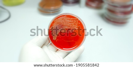 Staphylococcus aureus: Gram-positive, to Gram-variable, nonmotile, Coccus, saprotrophic bacterium that belongs to the family Staphylococcus growth on blood agar contains small yellow grains.