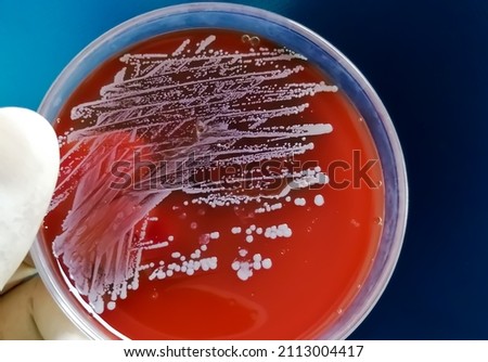 Staphylococcus aureus: Gram-positive, to Gram-variable, nonmotile, Coccus, beta hemolysis, saprotrophic bacterium that belongs to the family Staphylococcus growth on blood agar.