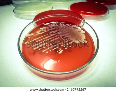Staphylococcus aureus: Gram-positive, to Gram-variable, nonmotile, Coccus, beta hemolysis, saprotrophic bacterium that belongs to the family Staphylococcus growth on blood agar