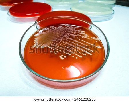 Staphylococcus aureus: Gram-positive, to Gram-variable, nonmotile, Coccus, beta hemolysis, saprotrophic bacterium that belongs to the family Staphylococcus growth on blood agar