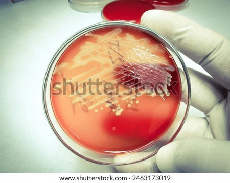 Staphylococcus aureus: Gram-positive, to Gram-variable, nonmotile, Coccus, beta hemolysis, saprotrophic bacterium that belongs to the family Staphylococcus growth on blood agar