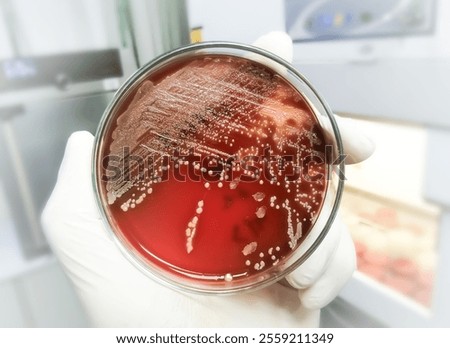 Staphylococcus aureus: Gram-positive, to Gram-variable, nonmotile, Coccus, beta hemolysis, saprotrophic bacterium that belongs to the family Staphylococcus growth on blood agar.