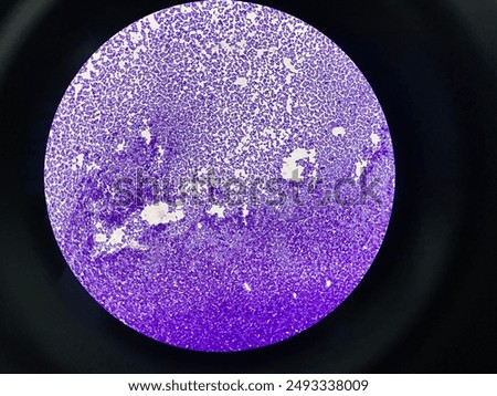Staphylococcus bacteria under the microscope