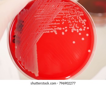 Staphylococcus Colony On Blood Agar Plate