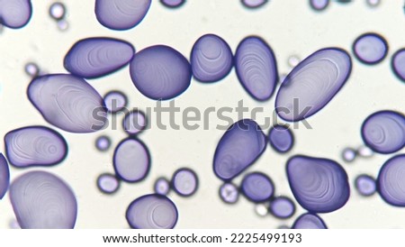 Starch granules of potato. Potato leucoplast contains starch. Stained by lugol iodine. 400x magnification with selective focus