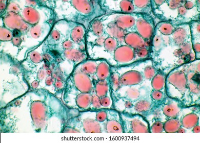 Starch in potato cells (Solanum sp.)