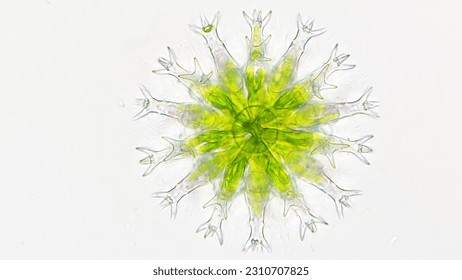 Staurastrum rotula, a microalgae with a lot of hand-like structure. Live cell. 40x objective lens. Selective focus