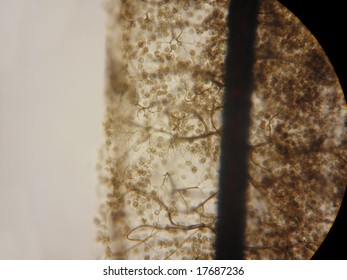 Stemonitis Slime Mold High Power Microscopic Stock Photo 17687236 ...