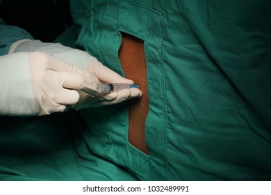 Surgical Operation On Right Supraclavicular Lipoma Stock Photo (Edit