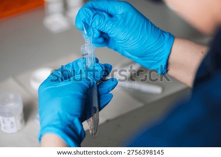 Sterile Gloves Skillfully Manage Tiny Vials. Ensuring Accuracy And Sterility In Microsample Manipulation