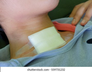 sterile tracheostomy wound care with gauze - Shutterstock ID 559731232