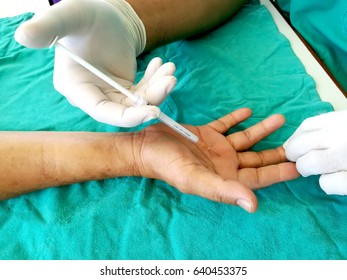 steroid injection to palmar  for treatment  trigger finger 