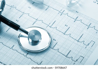 Stethoskop auf dem Kardiogramm