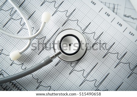 Stethoscope on EKG graph background. Medicine concept