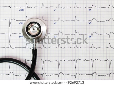 Stethoscope on the electrocardiogram (ECG) graph (top view)