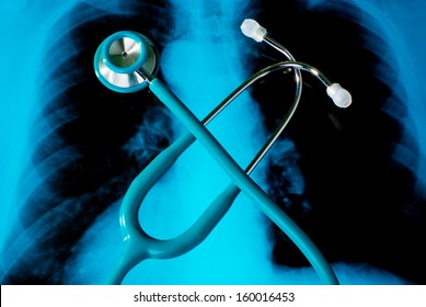 Stethoscope On An Xray Photo Of Lungs 