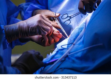 10,018 Surgery Stitching Images, Stock Photos & Vectors | Shutterstock