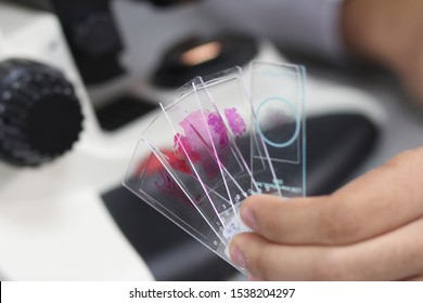 Stock photo of detail of some laboratory samples with histologist tissues and blurred microscope in background.