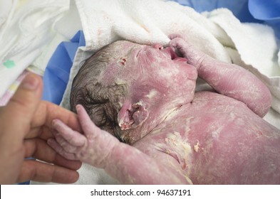A stock photo of a new born baby girl holding father's finger. The white waxy substance is vernix caseosa which is found on the skin of newborn babies.
