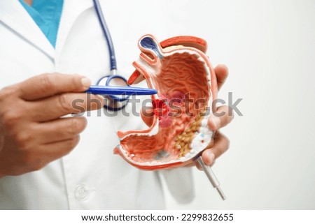 Stomach disease, doctor holding anatomy model for study diagnosis and treatment in hospital.