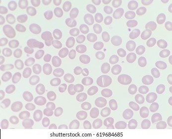 Stomatocyte Images, Stock Photos & Vectors | Shutterstock