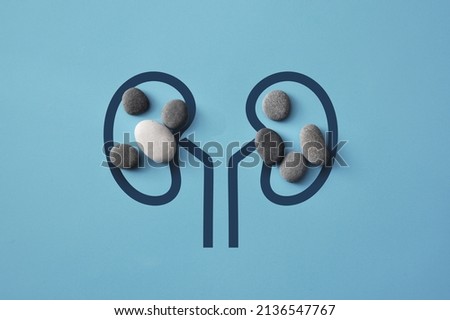 Stones on the silhouette of the kidneys. A symbol of kidney disease. Kidney stones