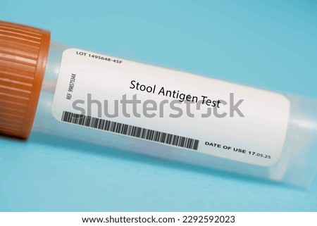 Stool Antigen Test This test detects the presence of specific antigens in the stool, which can be indicative of infections such as H. pylori, a bacteria that can cause ulcers.