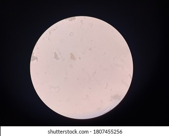 
Stool examination under direct smear, then microscope performed 40x magnification And show the Entamoeba coli cyst 8 nucleus. Stock Photo