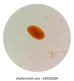 Stool Parasites Examination Test Parasites Eggs Stock Photo 630328289 Shutterstock Stool Parasites Examination Test Parasites Eggs Stock Photo 630328289 Shutterstock