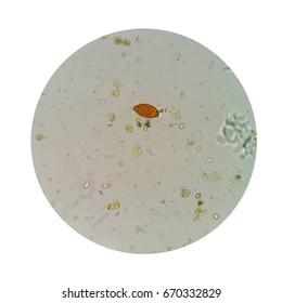 Stool Parasites Examination Test Parasites Eggs Stock Photo 675389572 Shutterstock Stool Parasites Examination Test Parasites Eggs Stock Photo 675389572 Shutterstock
