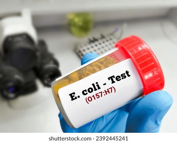 Stool sample for E. coli O157:H7 test. Serotype of Escherichia coli bacteria.
