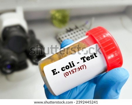 Stool sample for E. coli O157:H7 test. Serotype of Escherichia coli bacteria.